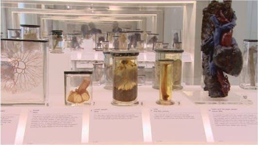 Surgeons' Hall Museums photo 4